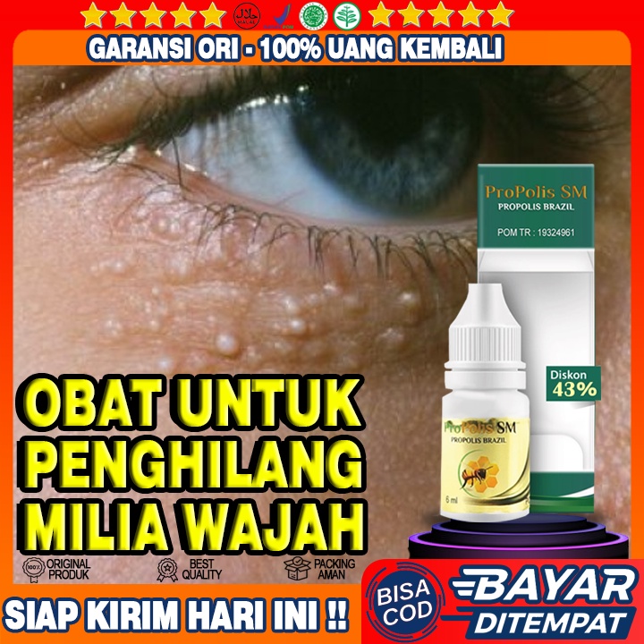 Obat Milia di Wajah, Obat Beruntusan Di Wajah, Obat Beruntus Di Wajah, Obat Wajah Beruntusan