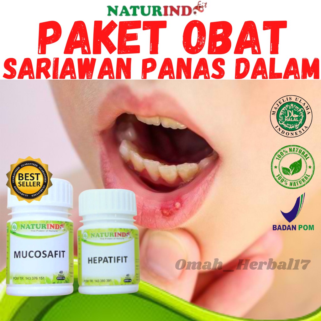 Paket Obat Sariawan Panas Dalam Obat Sariawan Menahun Obat Infeksi Jamur Dimulut