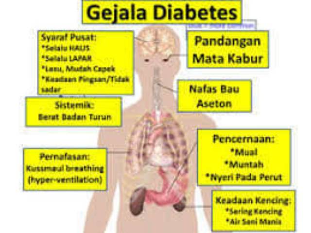 Java Bet (kusus Untuk Diabetes) Nasa