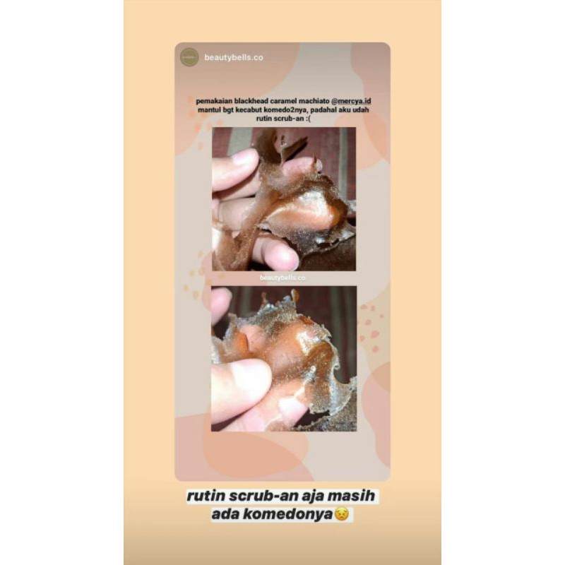 Blackhead Face Mask By Mercya Id Shopee Indonesia