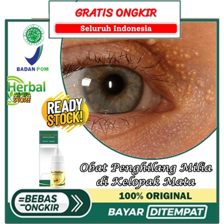 Obat Penghilang Milia di Kelopak Mata, Salep Cair Milia di Kelopak Mata Bawah, Obat Oles Milia di Ke