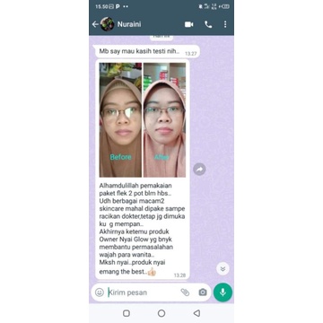 Nyai Glow Skincare paket flek dokter sukma 100% produk ori