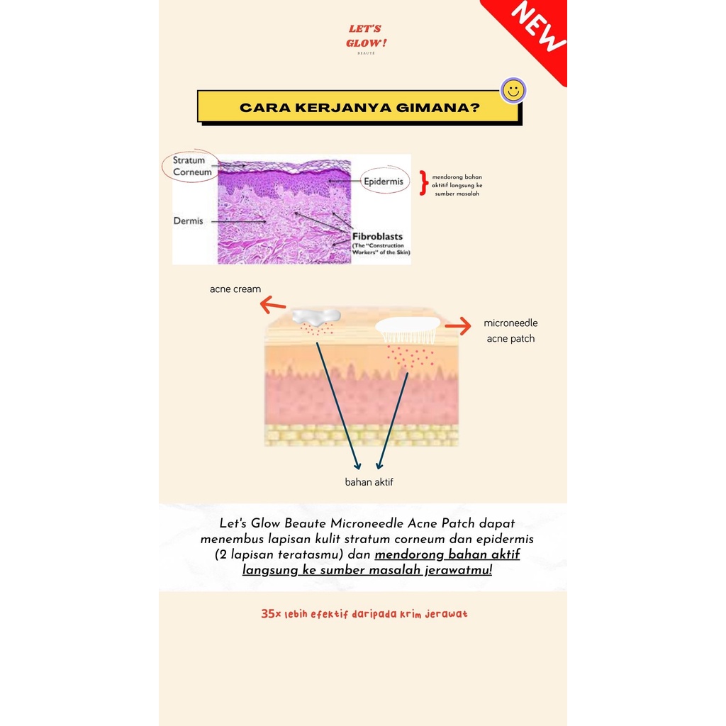 MICRONEEDLE ACNE PIMPLE PATCH PREMIUM MURAH
