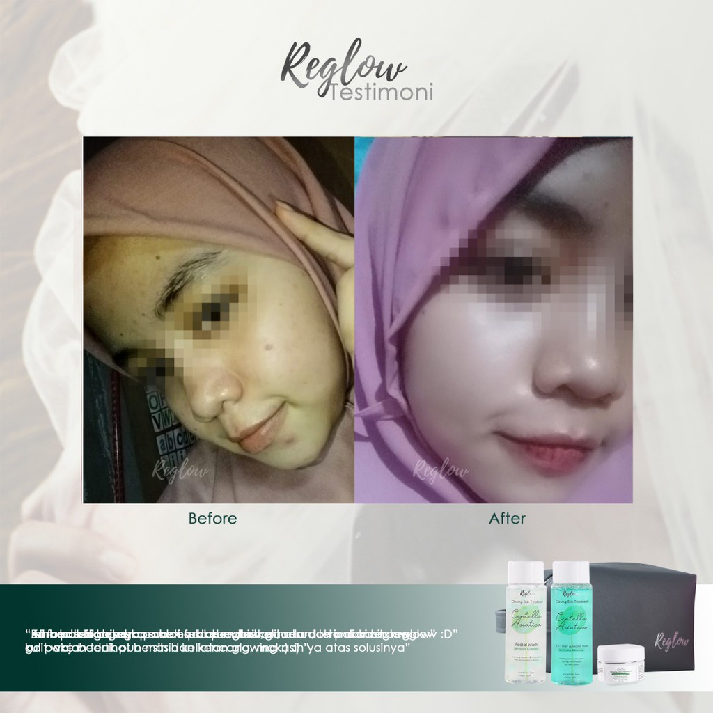 Reglow Skincare Original dr. Shindy Putri Bpom Paket Glowing Skin Treatment