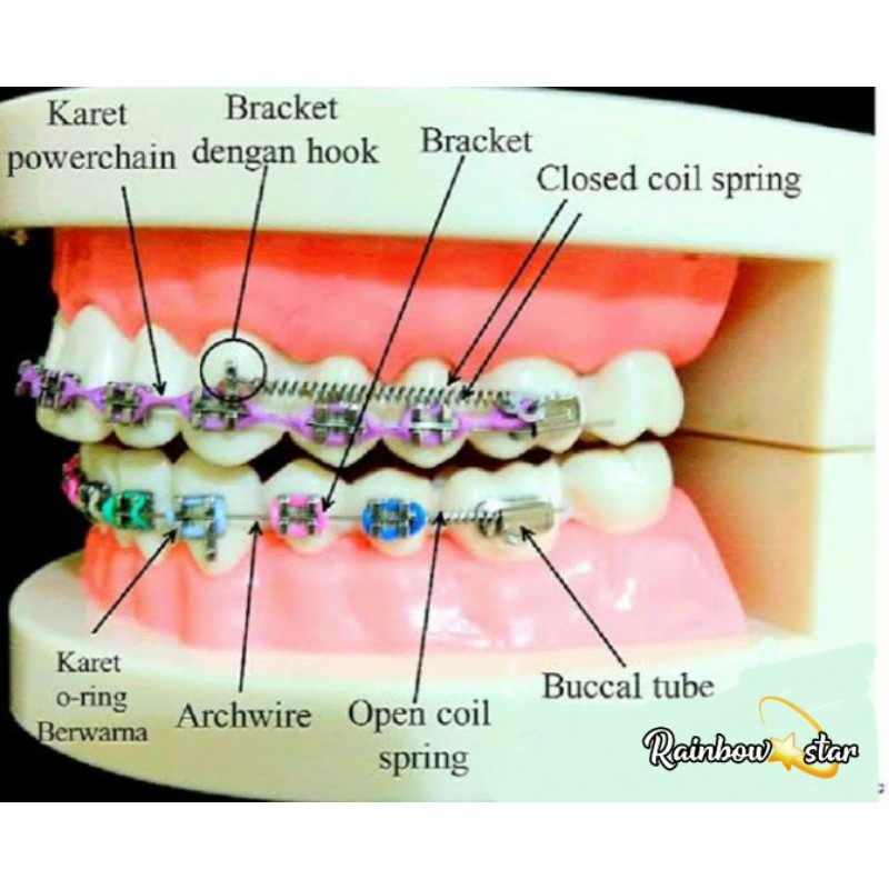 Patung Gigi / Manekin Gigi / Dental Model Gigi