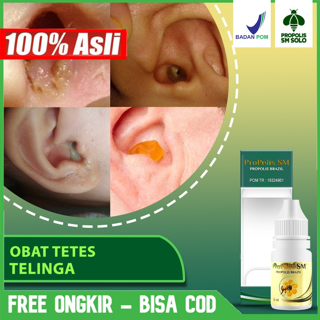 Obat Tetes Telinga Tersumbat, Telinga Budeg Sebelah, Telinga Berair Laris PROPOLIS BRAZIL SM Di SOLO