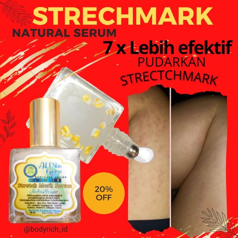 ALARICE STRECHMARK CREAM PENGHILANG STRETCH MARK PALING AMPUH PERMANEN UNTUK IBU HAMIL 1