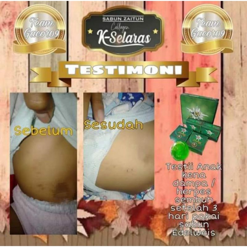 Sabun Bulus Edelweis K-selaras ORIginal bpom aman