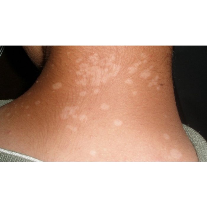 Salep GTL Original 100% Asli Gatel Usir Kudis Kurap Panu Korengan-5