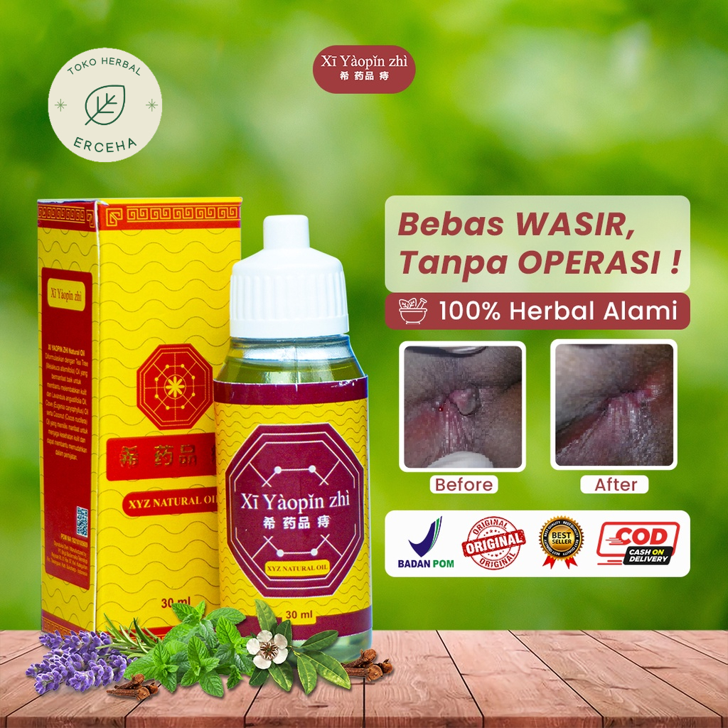Xi Yaopin Zhi Oil Wasir Ambeyen Ambeien Ambeiyen Oles Tanpa Operasi Kempeskan Benjolan Ampuh Aman Tanpa Efek Samping
