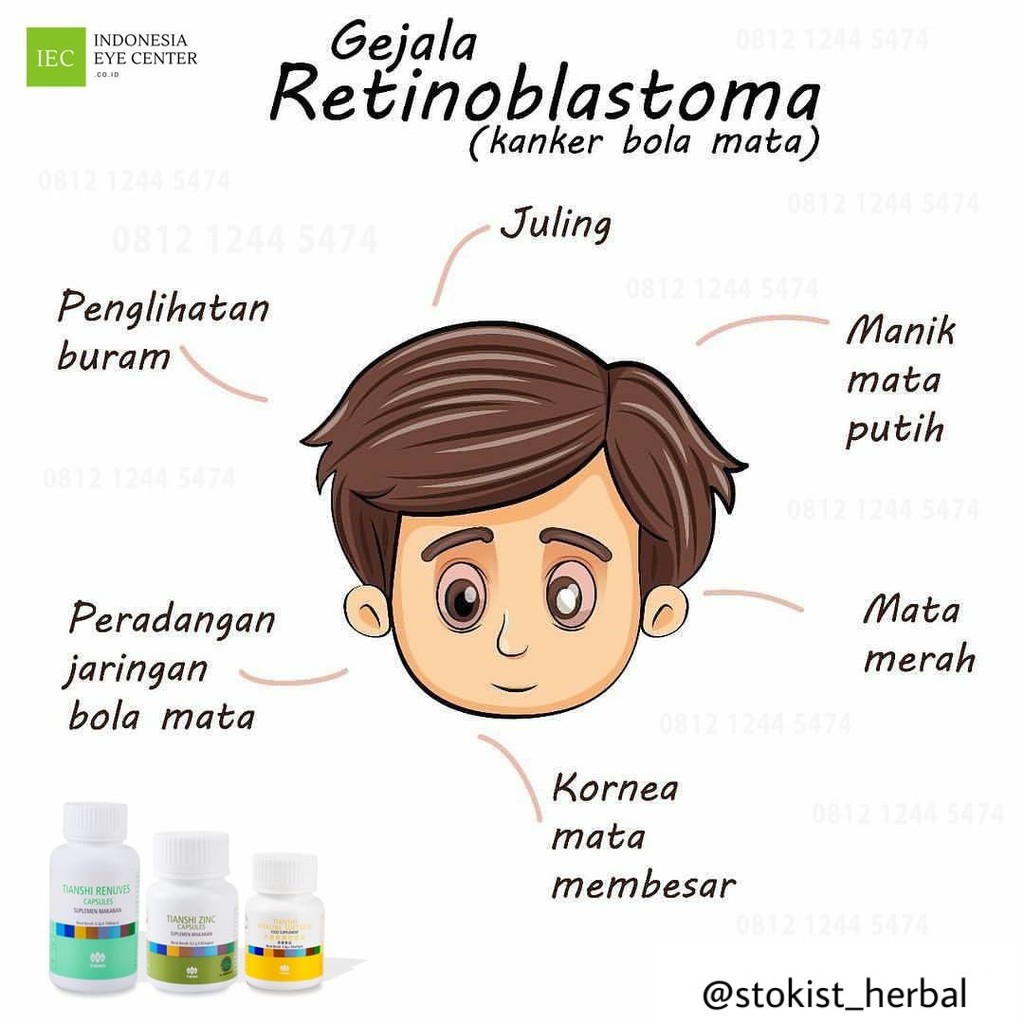 Vitamin Tiens untuk mata / Terapi mata minus / mengurangi mata minus