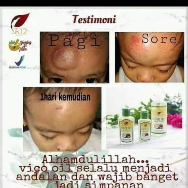 

Vico oil (minyak kelapa)