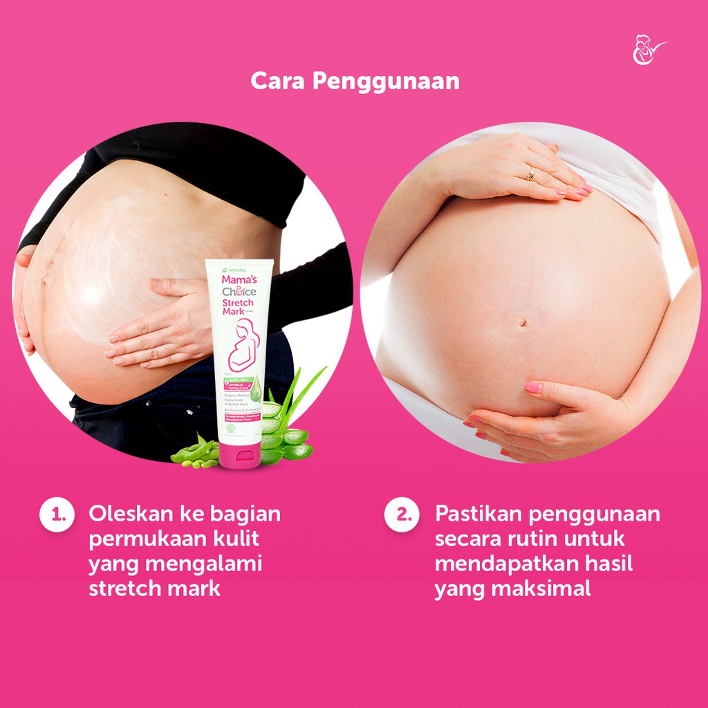 Mama's Choice Stretch Mark Cream (Solusi Perut Gatal dan Stretch Mark) - 100ml