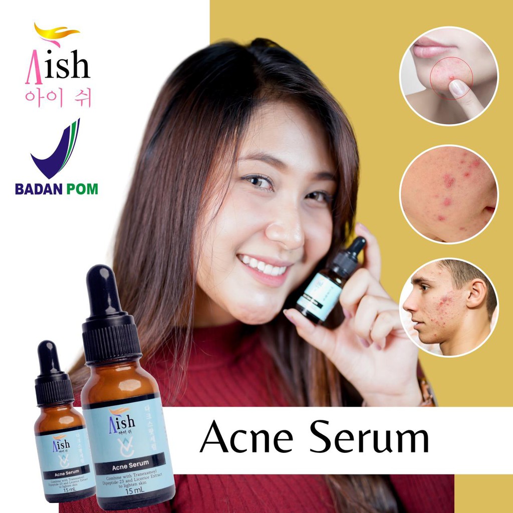 Aish serum 2 Pcs Aish Acne Aish acne care serum Aish acne serum korea Aish acne care Aish acne serum