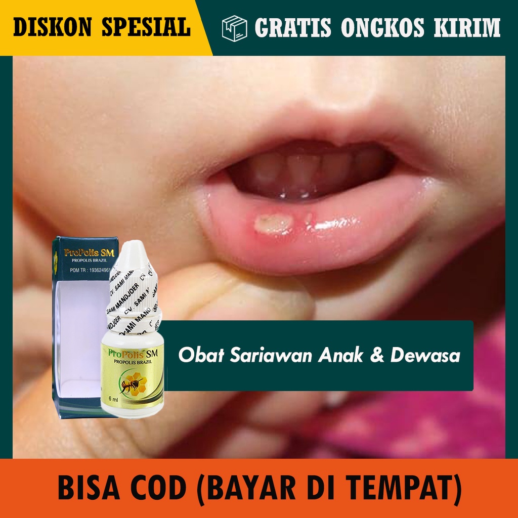 Jual Cod Obat Sariawan Di Lidah Gusi Bibir Obat Luka Di Mulut Obat Tetes Sariawan Untuk