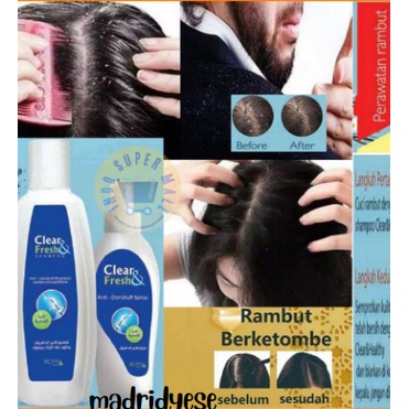 [ORIGINAL] MY WAY shampo clear fresh ampuh banget buat ketombe yang parah sekalipun - My Way Sampo A