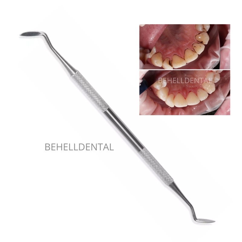 ALAT KIKIR PENGHILANG PLAK KARANG TARTAR GIGI SONDE PIPIH 2 SISI Behelldental / Alat standart dental diagnostic diagnostik kit set / scaler scaller pembersih karang gigi manual  / standar sonde halfmoon stainless scaler scaller ampuh // dokter gigi