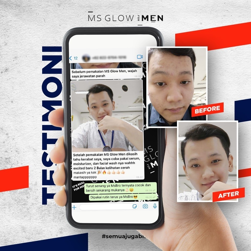 MS Glow Men Paket Basic Complete Skincare Pria Ms Glow For Men Original BPOM Free Pouch / Paket Ms Glow Men Paket Perawatan Wajah