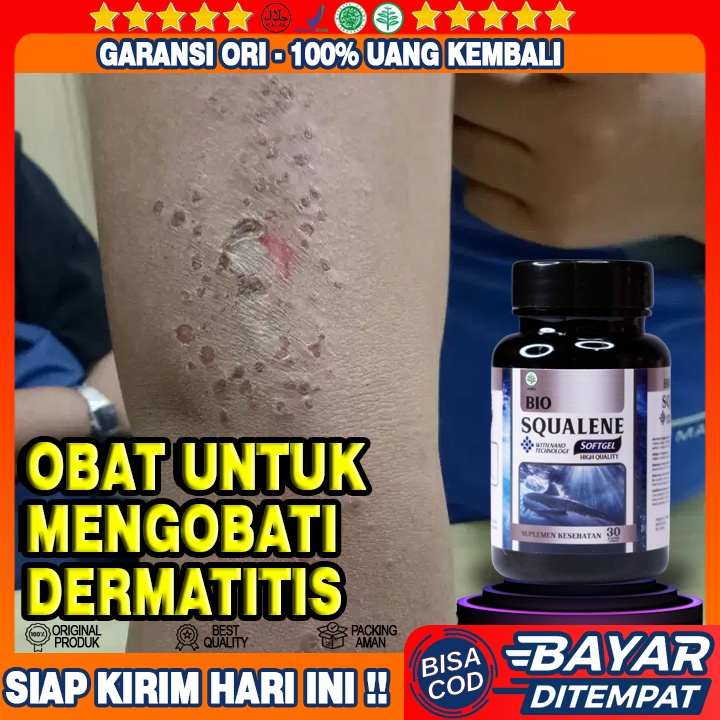 Obat Dermatitis Gatal - Obat Eksim Basah - Obat Ruam Merah - Obat Gatel Selangkangan Hitam - Obat Ku