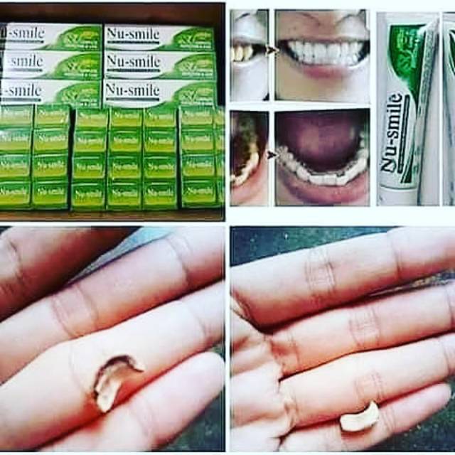 NU -smile