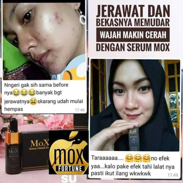 

moxskincare