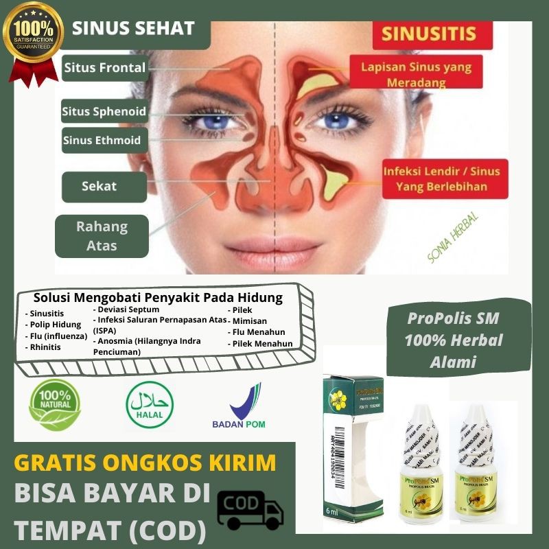 Obal Tradisional Untuk Hidung Tersumbat - Hidung Mampet -Obat Hidung Gatal lPropolis SM Herbal Alami
