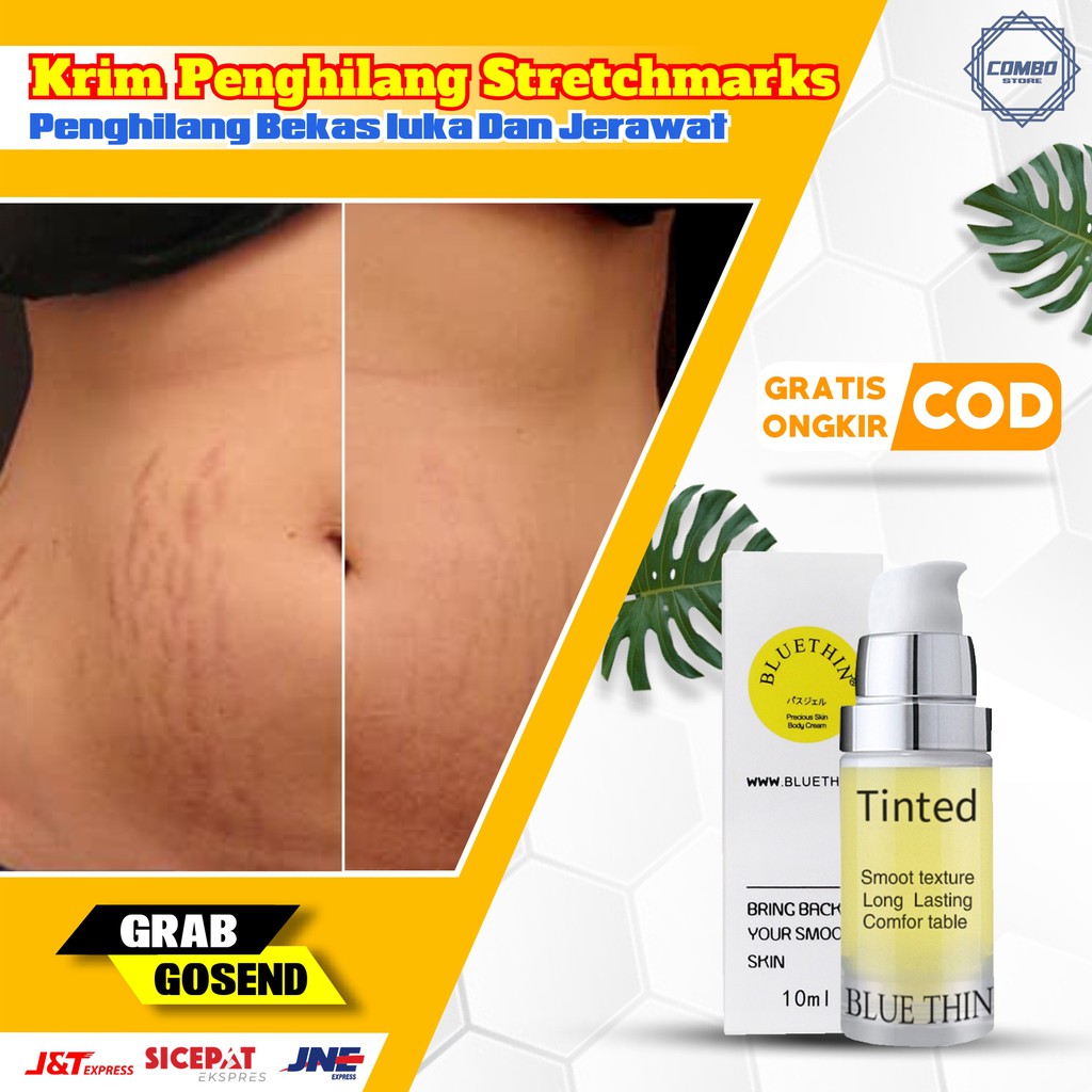 Krim Penghilang Bekas Luka Stretchmarks Dan Bekas Jerawat Ampuh