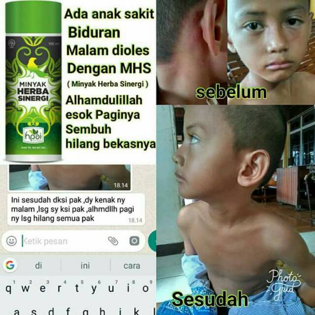 

Minyak Herbal Sinergi