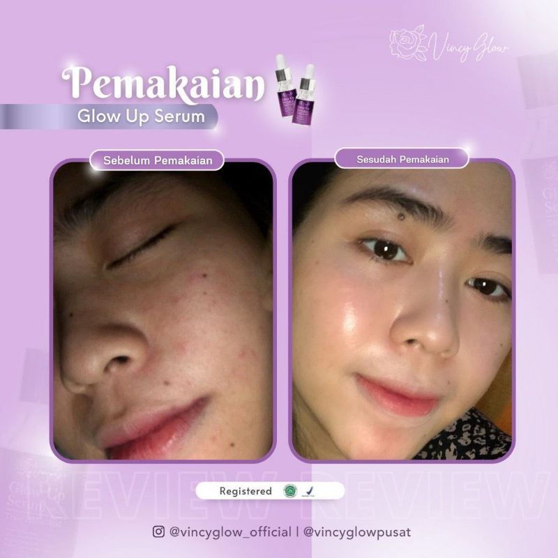 Vincy glow whitening paket karma BPOM,