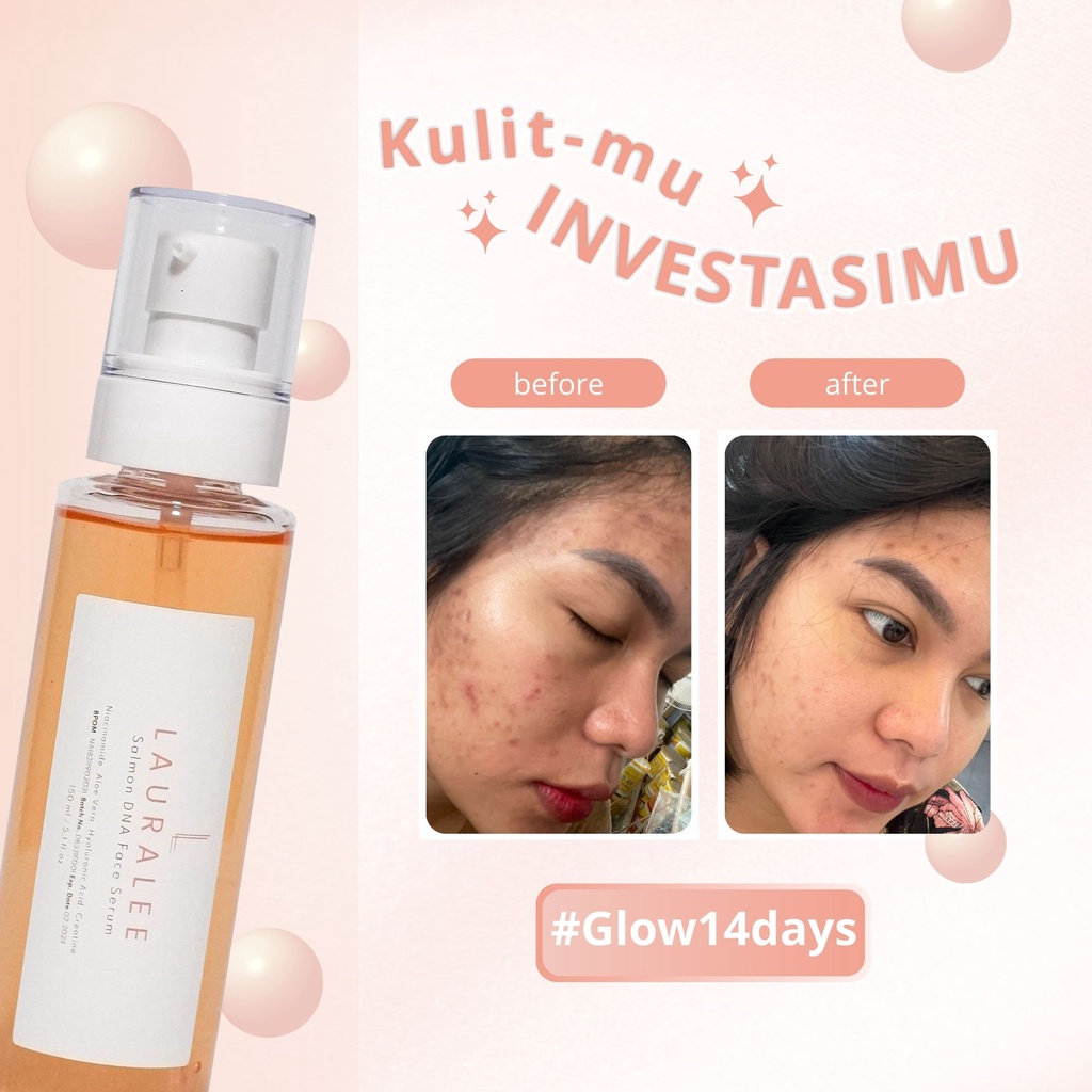 Lauralee Combo Brightening Serum Salmon DNA 150ML & Sabun Salmon DNA 2in1-6