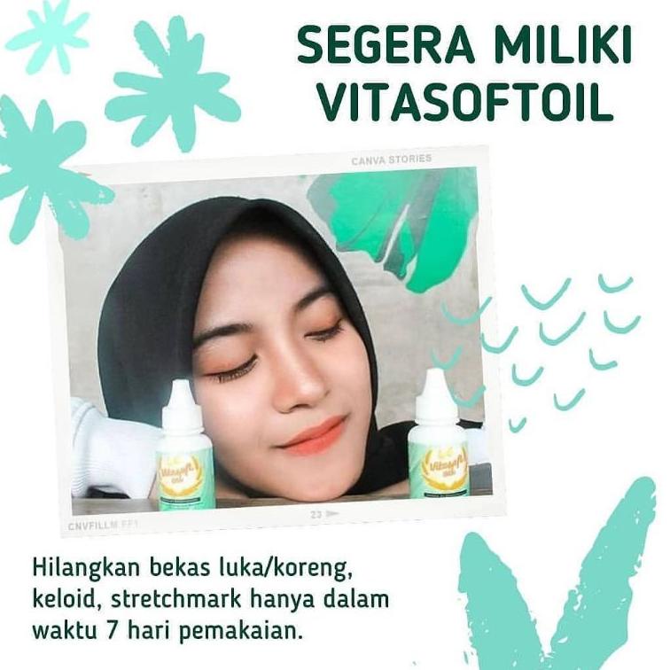 [KODE SRT90] VITA SOFT OIL ORIGINAL TERBAIK VITASOFTOIL/AMPUH HILANGKAN BEKAS LUKA/KORENG/BENJOLAN