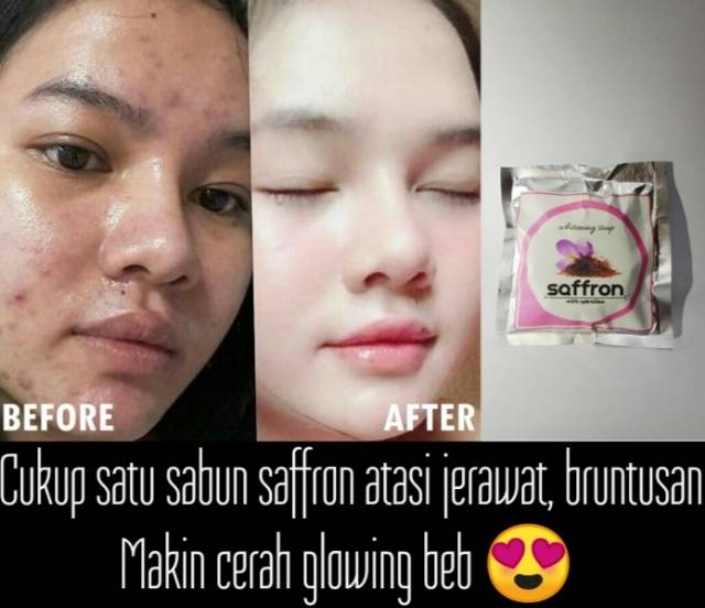 Sabun Saffron With Spirulina Safron Untuk Jerawat Bruntusan Flek Hitam Pemutih Wajah Sabun Wajah Indonesia