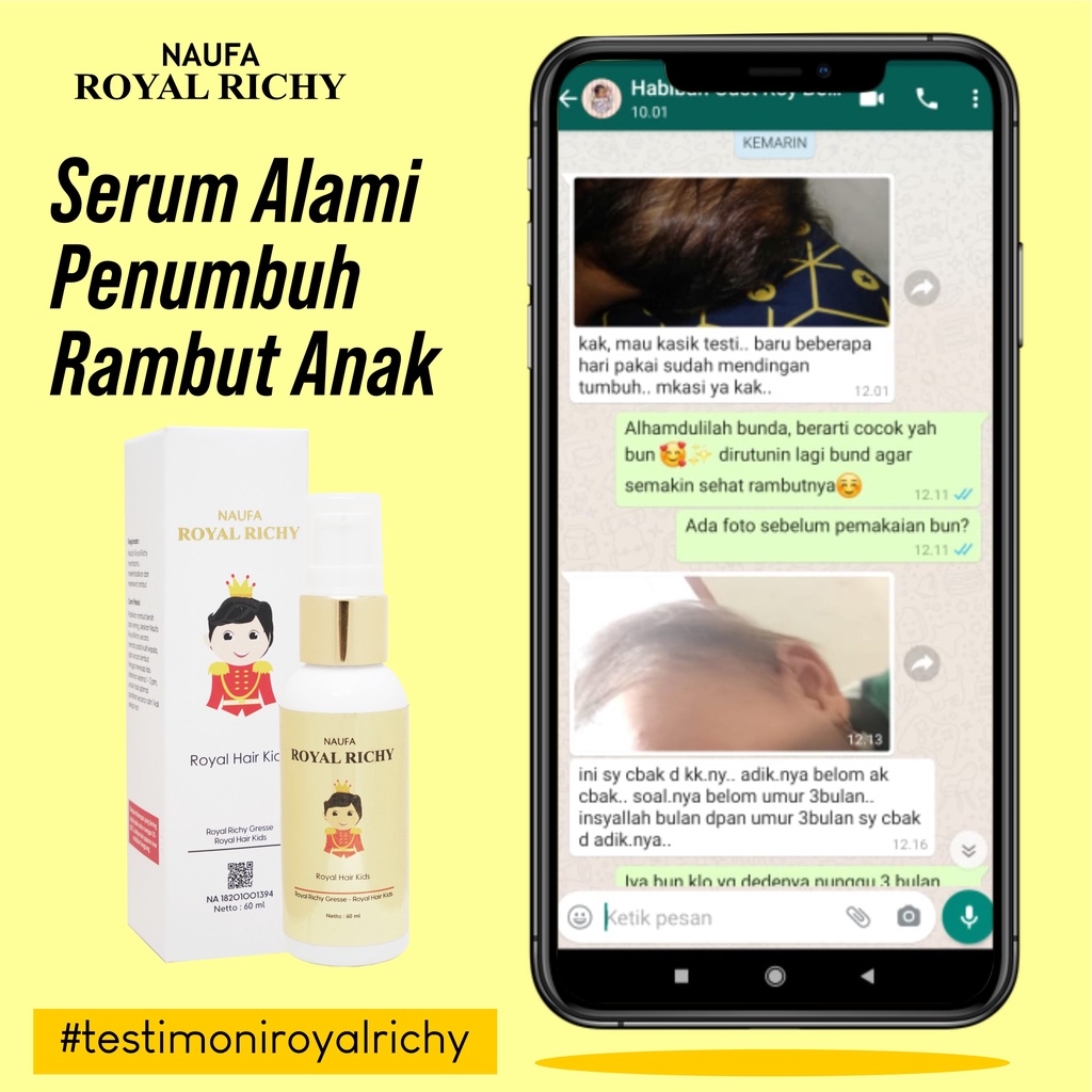 Naufa Royal Richy -  Serum Multivitamin Minyak Kemiri Penumbuh Penyubur &amp; Penebal Rambut Anak Bayi &amp; Dewasa