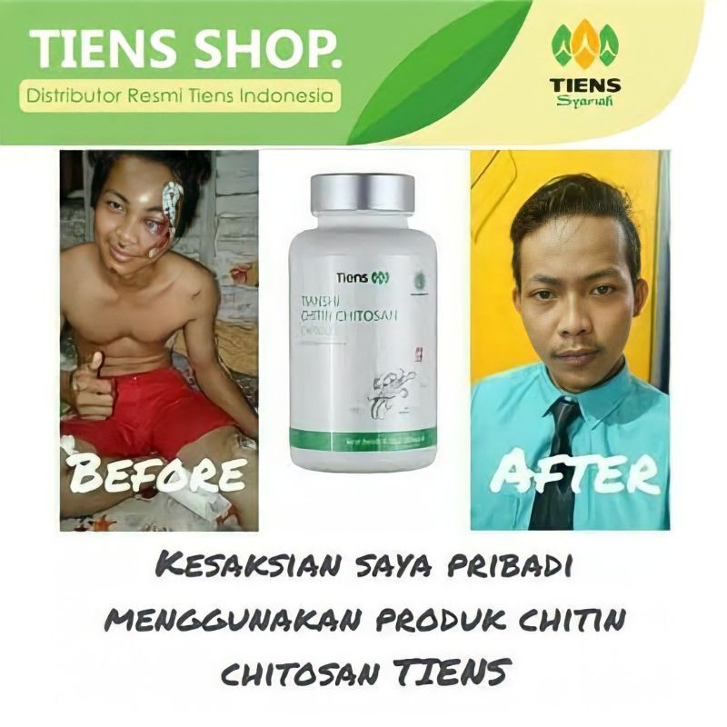 PENGHILANG BEKAS LUKA AMPUH