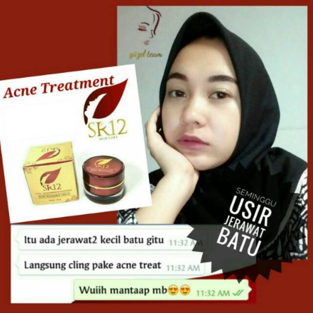 ACNE TREATMENT CREAM / KRIM JERAWAT SEDANG SAMPAI BERAT YANG DISERTAI RADANG INFLAMASI