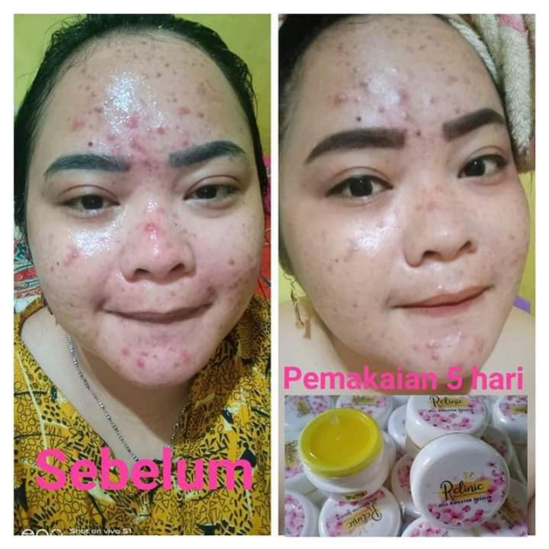 Rclinic (salep pelicin)