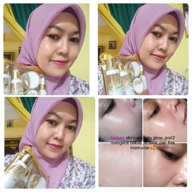 RATU GLOW SKINCARE ORIGINAL PEMUTIH WAJAH GLOWING PENGHILANG FLEK JERAWAT RATU GLOW REGULER RATU GLOW BPOM