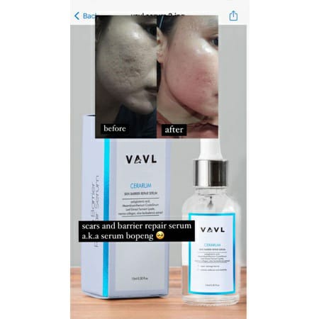 (READY) VAVL CERARUM BARRIER REFAIR SERUM 15 ML / VAVL SERUM BOPENG SKIN BARRIER REPAIR SERUM