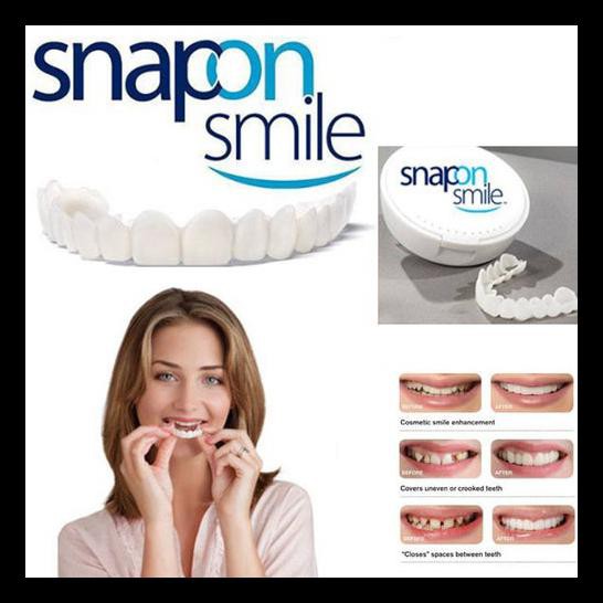 TERLARIS Snap On Smile 100% ORIGINAL Authentic / Snap 'n Smile Gigi Palsu