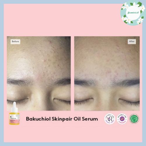 [SALE!] SOMETHINC Bakuchiol Skinpair Oil Serum 20ml