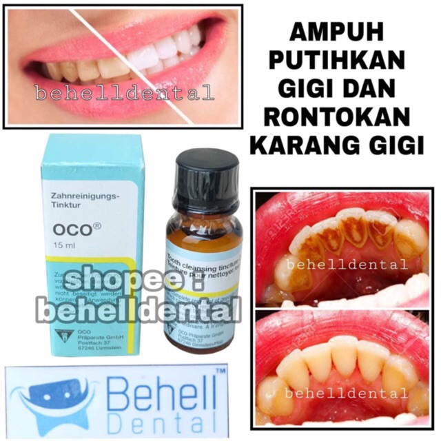 Pemutih Gigi Oco / Bahan Bleaching Gigi / Penghilang Karang Gigi dan noda gigi