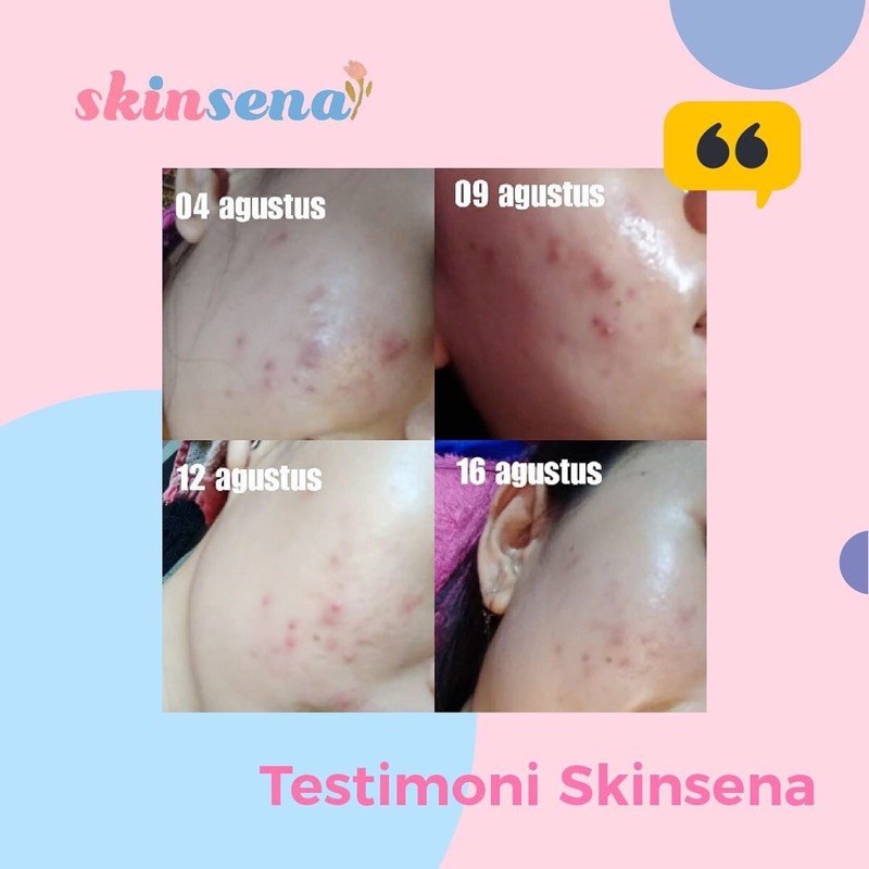 SKINSENA SKINCARE FACE GLOWING, ACNE SERIES, PAKET SKINCARE BPOM