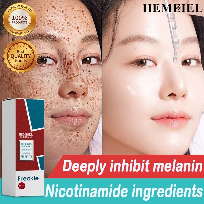 HEMEIEL Penghilang flek hitam Night whitening salep flek hitam White neng cream flek hitam penghilan