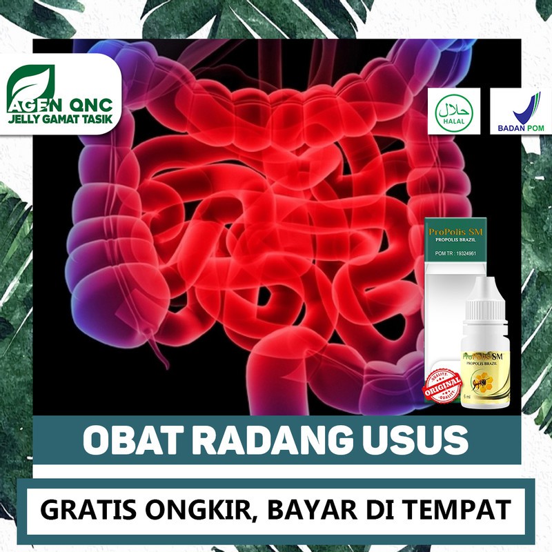 

Obat Radang Usus , Sakit / Nyeri Usus Besar Alami Terlaris - Kualitas PREMIUM Propolis SM 100% ASLI
