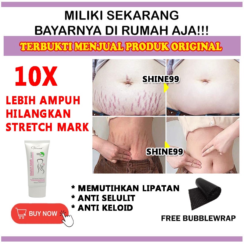 Penghilang Stretch Mark Ori Penghilang Bekas Luka Penghilang Stretch Mark Bokong Penghilang Selulit 