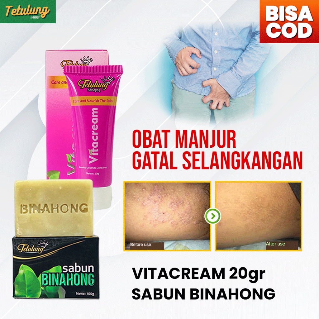 Jual Obat Salep Gatal Selangkangan Ruam Merah Bernanah Vitacream