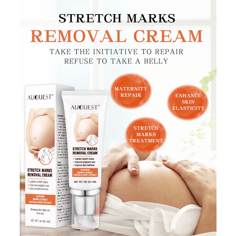 Penghilang strechmark  Strechmark cream Secara efektif menghilangkan stretch mark  Aman dan efektif