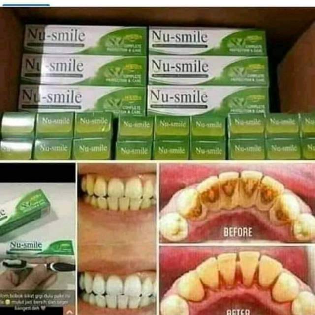 Nu smile