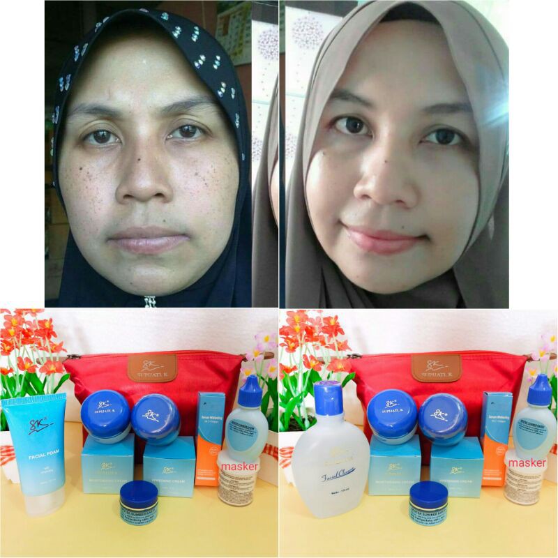 Paket Ampuh flek hitam dan whitening glowy SK  Supijati