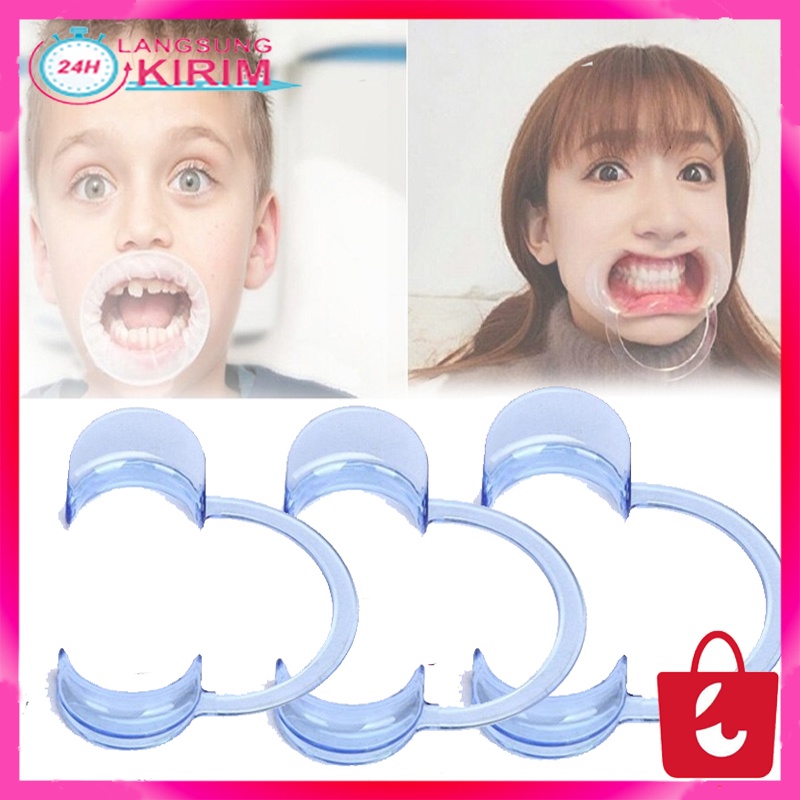 [BISA COD] alat Pembuka Mulut Untuk Pemasangan Behel Alat Pembuka Penyangga Mulut Mouthgate Elastis Anti Pecah Teeth Retractor Mouth Opener Veneer Gigi Behel